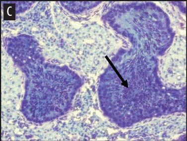 Figure 1c